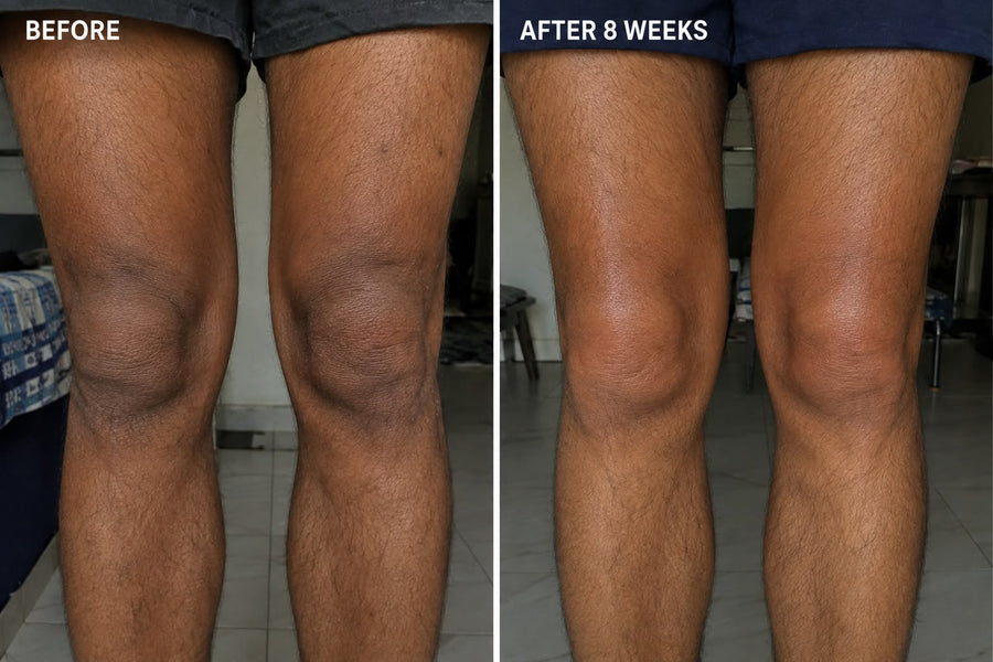 Haldayne before and after 8 weeks - knees
