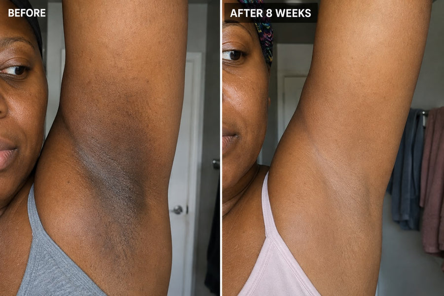 Haldayne before and after 8 weeks - underarm